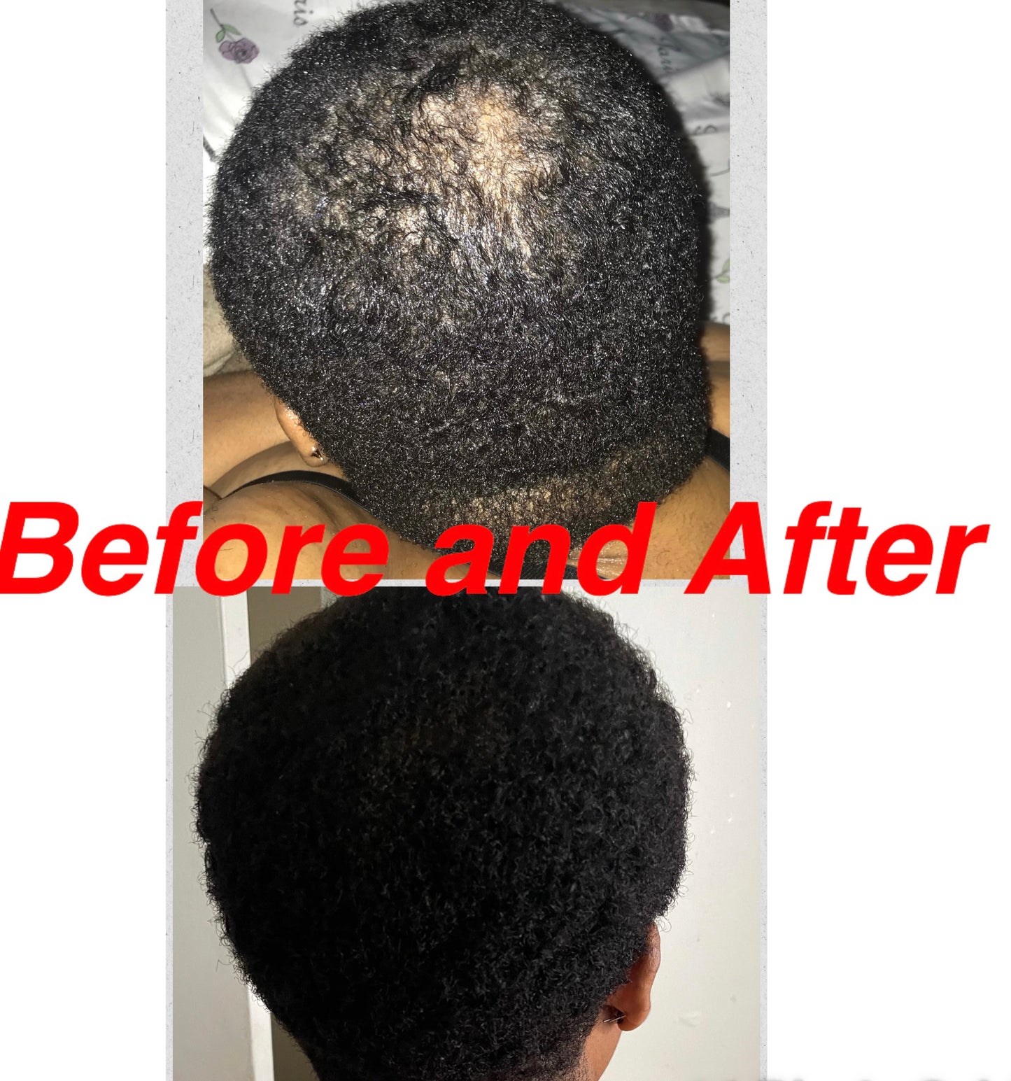 "Gro It Out" Hair Serum